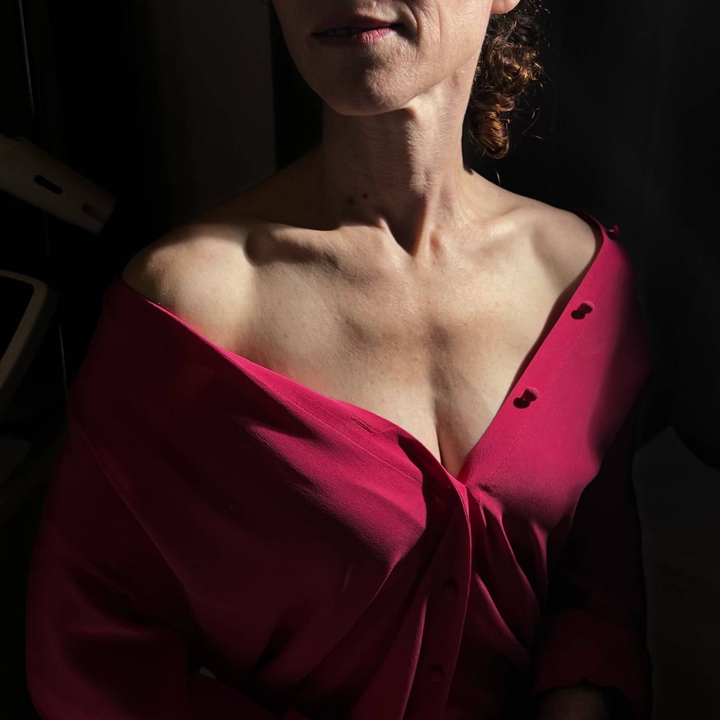 Dekolettee Hals Hautverjuengung Dokolletee Hautverjuengung