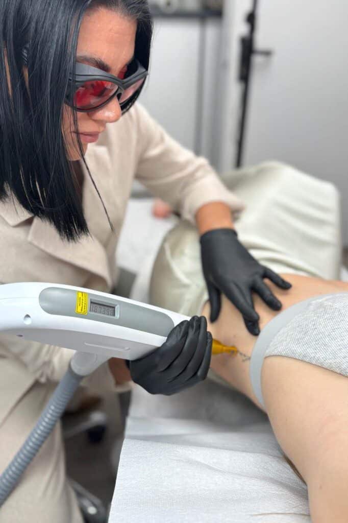 Behandlung Tatooentfernung