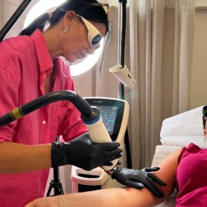 Frax Laserbehandlung Narbenentfernung