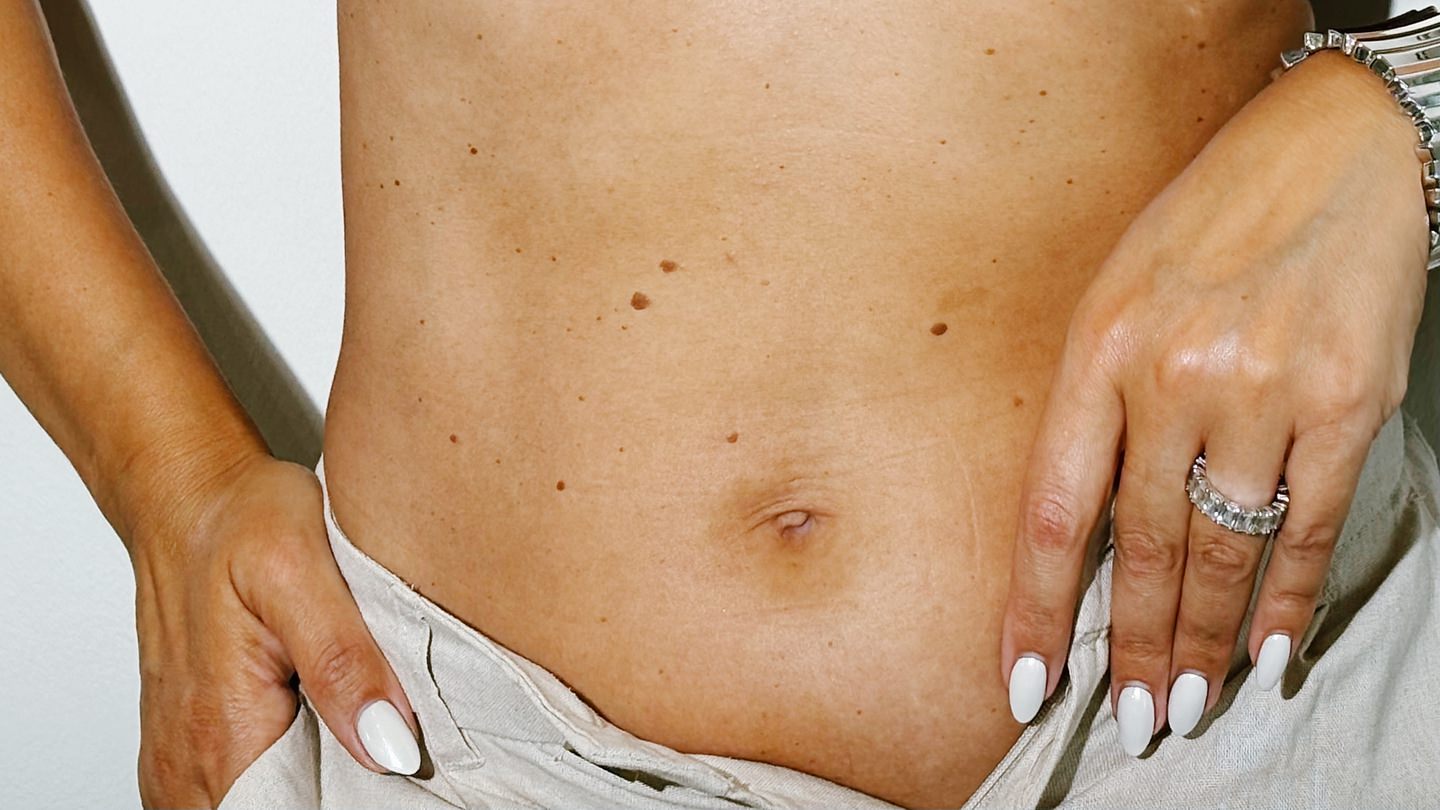 beine-permanente-haarentfernung Intimbleaching Bikinizone